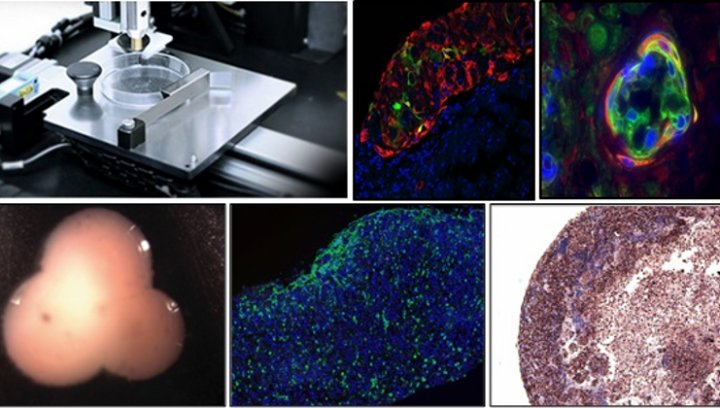 世界首个3D打印肾组织数据公布