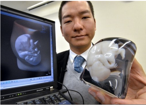 将核磁共振图片打印成胎儿模型的3D打印服务