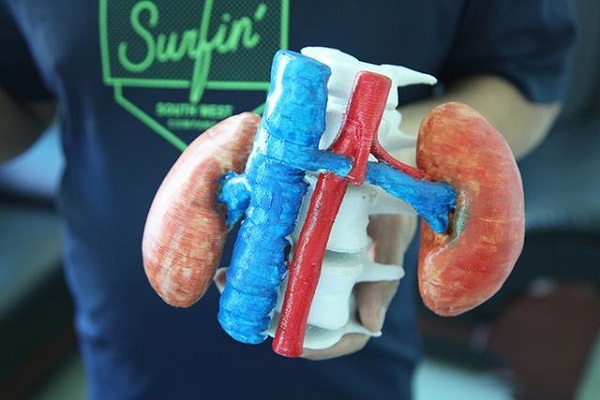 3D打印辅助治疗孩童期的漏斗胸
