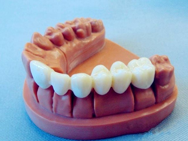 2025年全球牙科3D打印市场将超230亿