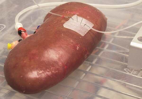 3D打印微流體設(shè)備或改善器官短缺狀況