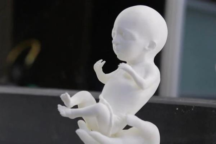 创新还是有违伦理？俄罗斯公司Embryo 3D为未来父母提供3D打印胎儿服务