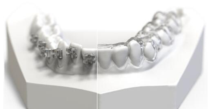 DETAX与黑格科技共研牙科树脂,3D打印助力口腔行业升级