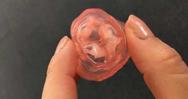 新的研究顯示3D打印有助于避免TAVR心臟手術(shù)的瓣周漏