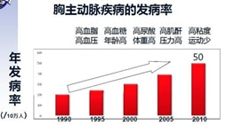 3D打印技術讓“最危險手術”到“幾乎不出血” 病人不再“開膛剖腹”