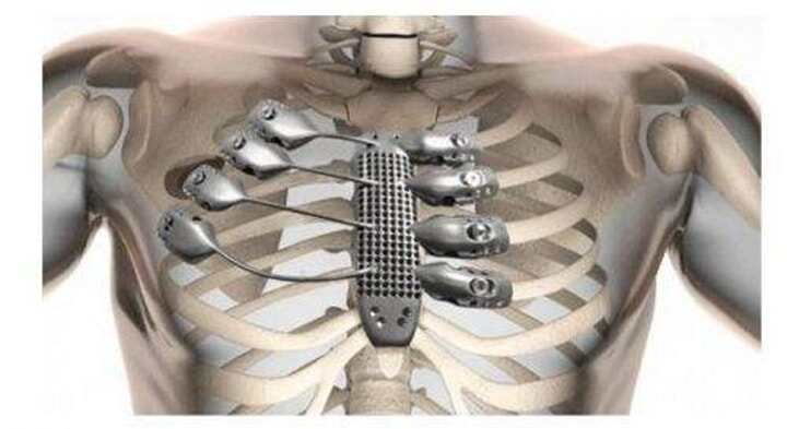 當(dāng)3D打印遇上醫(yī)療，可能以后不再需要活體器官了
