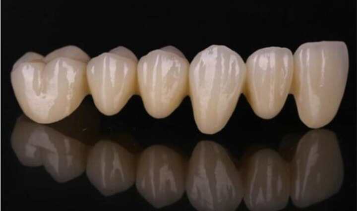 一張圖和四類案例了解陶瓷3D打印技術(shù)的醫(yī)療應用