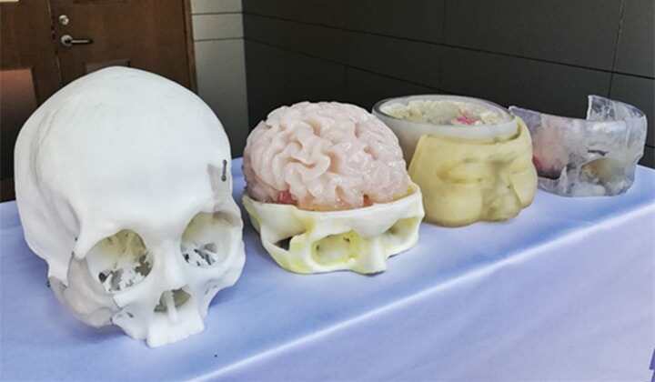 個性化醫(yī)療風起云涌 3D打印火熱醫(yī)療應用大盤點