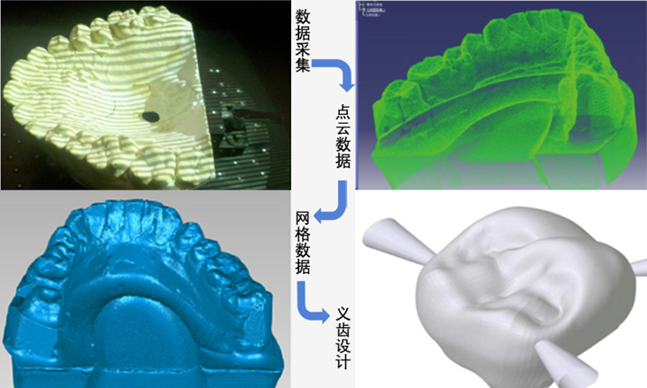 3D扫描牙齿，数字化齿科应用