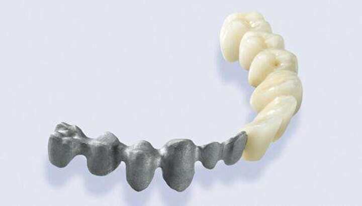 口腔醫(yī)學(xué)領(lǐng)域3D打印材料的研究進展