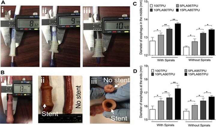 大西洋大學(xué)開發(fā)用于食道癌患者的3D打印柔性自擴(kuò)張支架