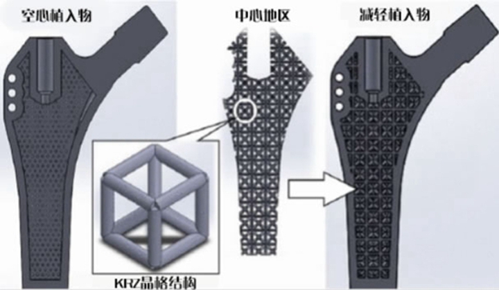 3D打印在制造钛质髋关节植入物的深入创新