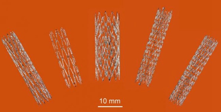 镍钛合金自膨胀血管支架3D打印研发取得新进展