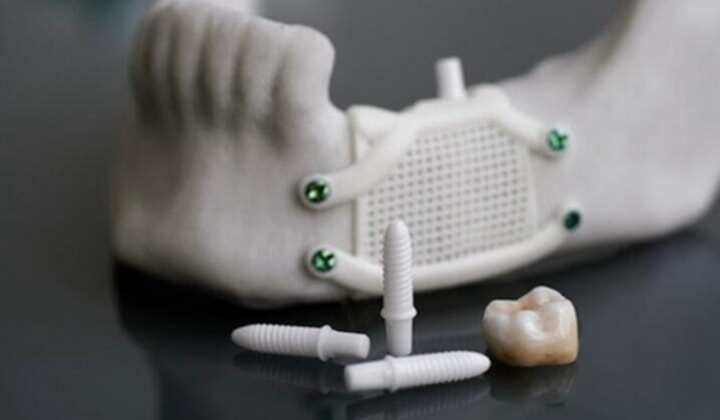 陶瓷3D打印使牙科產(chǎn)品邁出新的一步