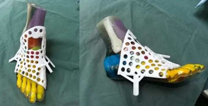 骨科診療邁入精準(zhǔn)醫(yī)療時(shí)代，3D打印技術(shù)為骨科手術(shù)“保駕護(hù)航”