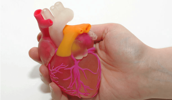 探索3D打印輔助模擬顱內(nèi)動(dòng)脈瘤顯微手術(shù)的應(yīng)用