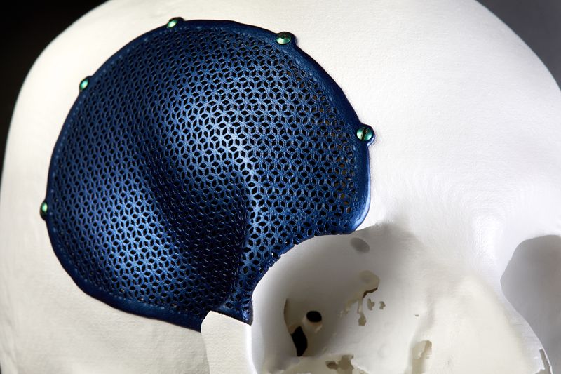 Materialize获得个性化3D打印医疗设备的CE标记认证