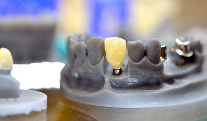研究人员通过3D打印更加接近再生牙科