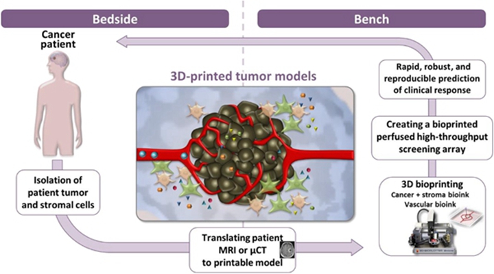 完整的肿瘤被3D打印出来以促进更快的治疗