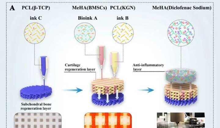 生物3D打印仿生支架促炎癥環(huán)境下骨軟骨缺損有效再生