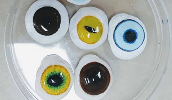 倫敦男子獲得“世界首個”3D打印義眼