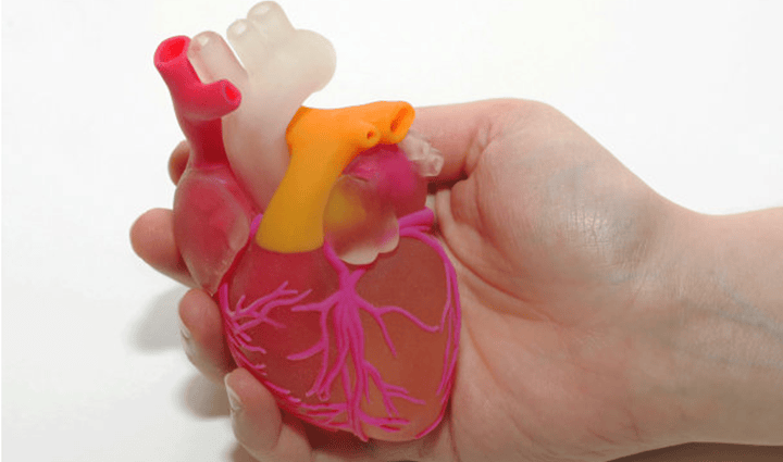 南科大醫(yī)院：巧用“3D打印+肉毒素”治療中風(fēng)后痙攣性癱瘓