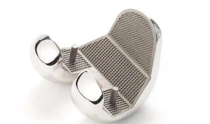 透視3D打印-增材制造金屬生物材料的種類及發(fā)展現狀