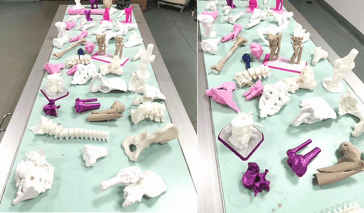 長沙市中醫(yī)院應(yīng)用3D打印技術(shù)制作百余例模型，助力精準(zhǔn)醫(yī)療