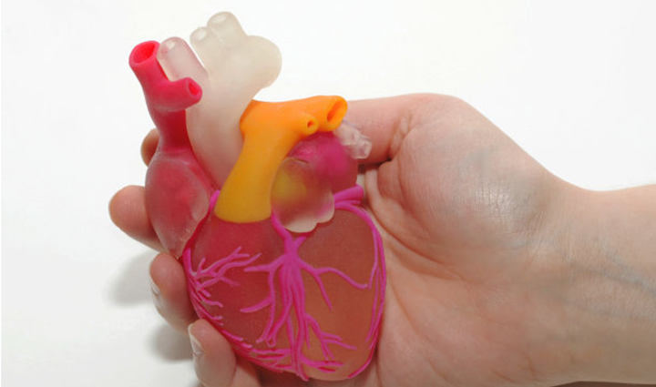 3D打印生长型心脏瓣膜，有望实现“一次植入、终身不换”