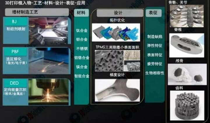 北醫(yī)三院3D打印鈦合金多孔內(nèi)植物大段骨缺損修復(fù)技術(shù)