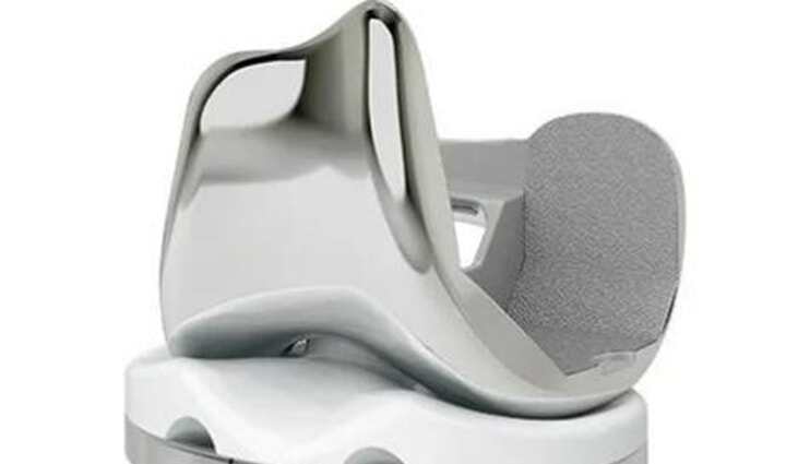 利用西門子NX將非骨水泥全膝關(guān)節(jié)置換術(shù) (TKA)建模和準(zhǔn)備時(shí)間減少50%