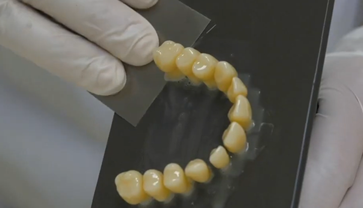 新研究发现3D打印在制作牙冠方面比铣削更准确