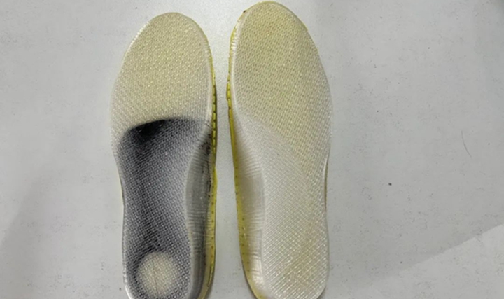 3D打印矫形鞋垫—扁平足治疗的新选择