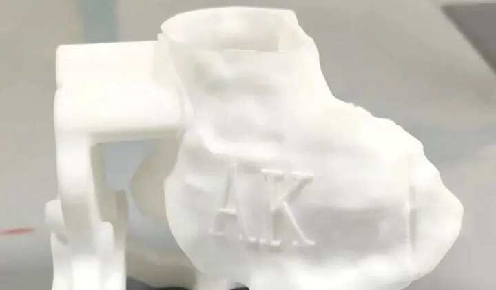 3D打印截骨導(dǎo)板輔助膝關(guān)節(jié)置換術(shù)解決了老人的膝關(guān)節(jié)疼痛