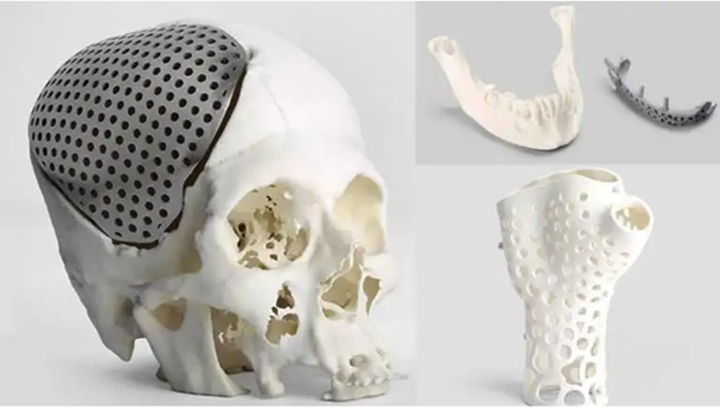 3D打印在骨科领域的应用和局限性