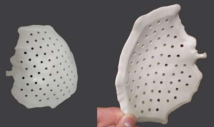 PEEK 3D在颅骨缺损方面的应用