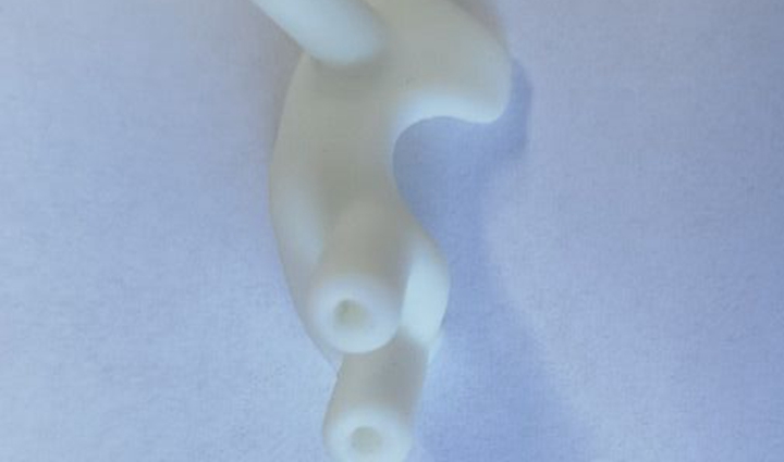 案例！3D打印技术完成骨折置钉导板设计并应用于临床