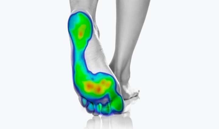 昆士蘭科技大學3D打印鞋墊項目，助力預防糖尿病患者截肢