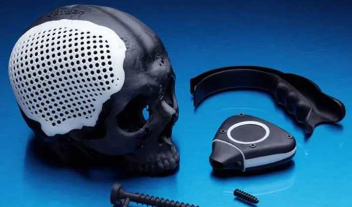 新材料促進(jìn)3D打印醫(yī)療領(lǐng)域的創(chuàng)新和發(fā)展