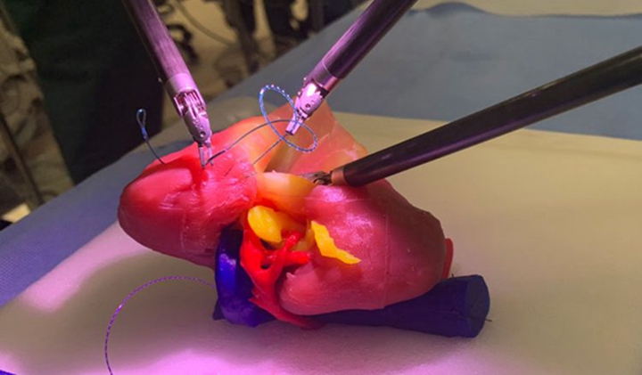 IVIVA 3D打印人工腎臟獲KidneyX獎，開創腎臟移植新路線 - 圖片