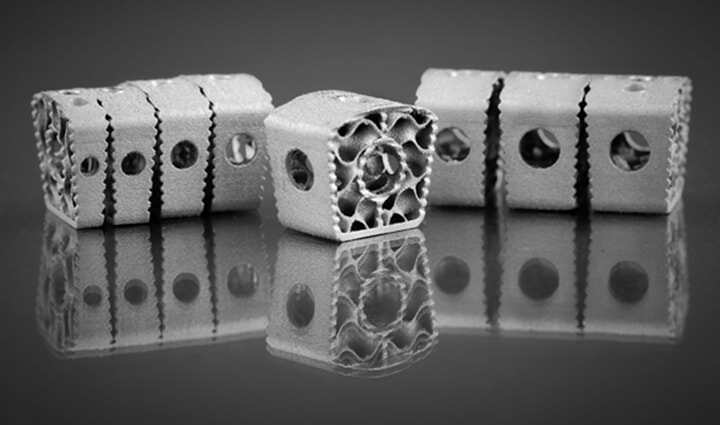 Restor3d收購Conformis，將共同打造個性化3D打印骨科領(lǐng)域的領(lǐng)導(dǎo)者