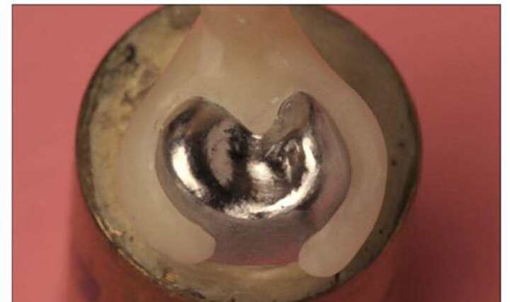 PEEK材料在口腔種植與修復(fù)領(lǐng)域的研究進(jìn)展