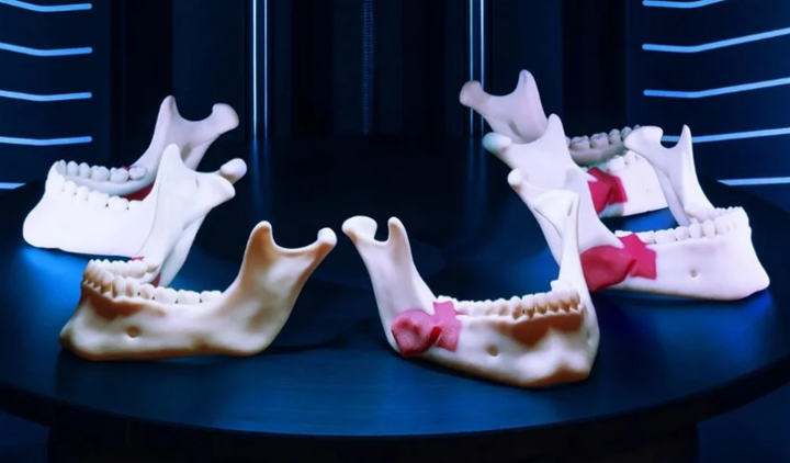 手術規(guī)劃和3D打?。何覀儸F在處于什么階段？