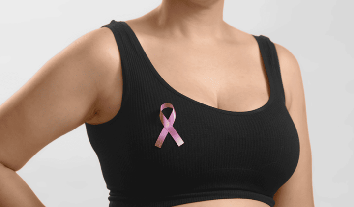 3D打印個(gè)性化乳房假體