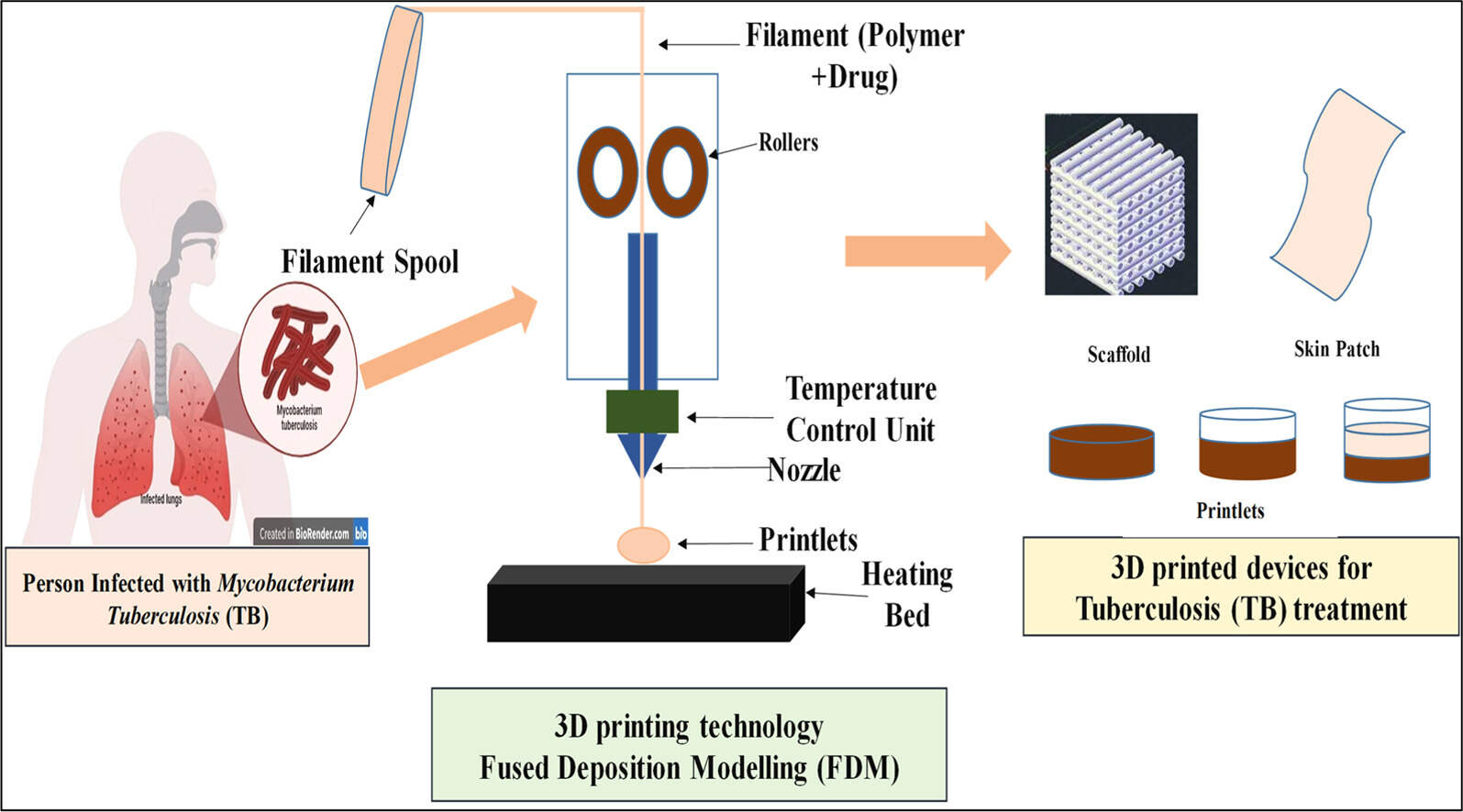 綜述：3D打印技術(shù)在兒童結(jié)核病治療上的應(yīng)用