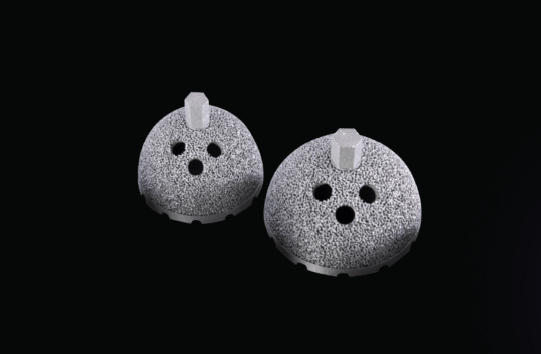 美法印三方合作，印度首個(gè)骨科植入物3D打印智能制造中心落地AMTZ - 圖片