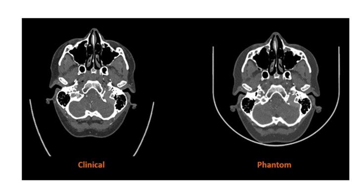 Stratasys擴(kuò)大醫(yī)學(xué)影像用防射線3D打印材料的應(yīng)用范圍 - 圖片