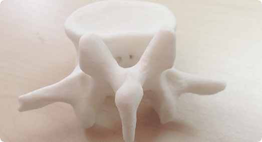 3d打印椎骨_骨骼_医疗_3d打印服务_魔猴网